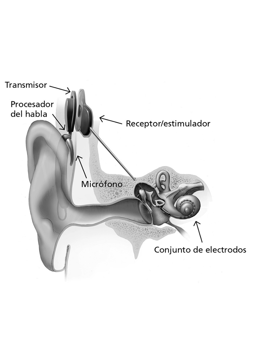tecnologia-04-Coclear-leordonez